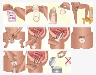 Before Using The Female Condom For The First Time During - Use Condom #9477191