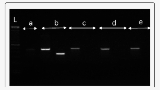 Photograph Of A Gel Showing The Separated Pcr Products - Monochrome #9523396