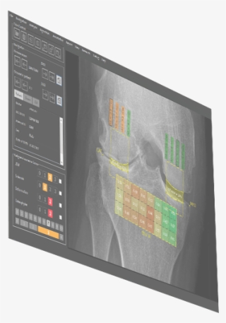 Image Biopsy Lab Software Laptop Image Biopsy Lab Software - Flat Panel Display #9534724