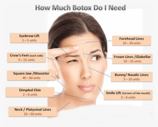 Botox Dosing Chart