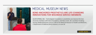 Bone Anchored Prosthetics Are Life Changing Innovations - Tread #9645592 Bone Anchored Prosthetics Are Life Changing Innovations - Tread #9645592
