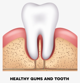 Healthy Gums - Periodontal Disease #9649946
