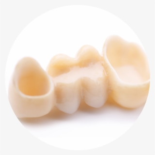 Crowns - Dessert #9649951