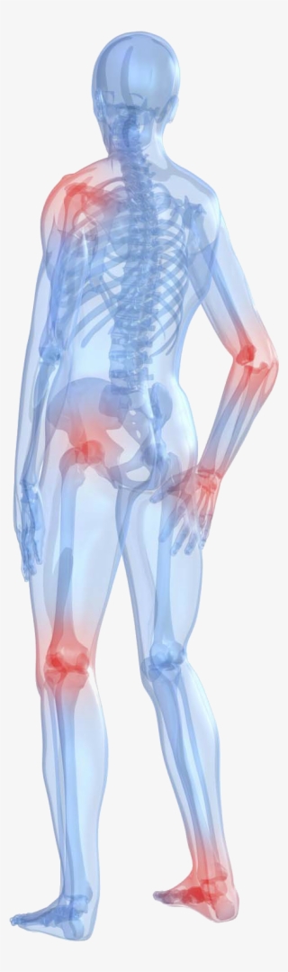 Me First Living Premium Standardized Turmeric Curcumin - Does Rheumatoid Arthritis Hurt #9695332