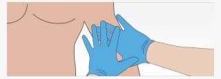 At The End Of Three Minutes, Apply A Pressure Dressing - Illustration #9714175