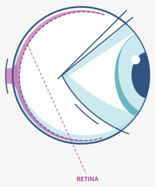 Accommodation Of To Different - Circle #9764075