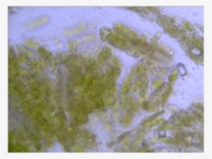 Bradford Pear Leaf - Chlorophyta #980206