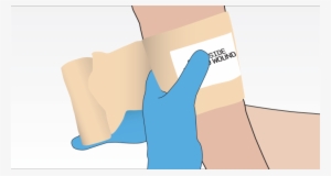 The Pressure Dressing - Junctional Rhythm #987014