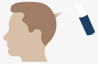 Hassle-free Process - #9863978