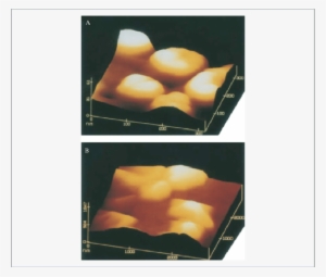 Afm Images Of Ha And Cppd Crystals From A Patient With - Calcium Pyrophosphate Dihydrate Crystal Deposition #991390