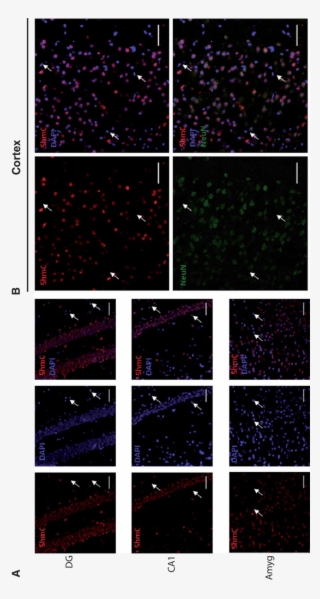The 5hmc Is Preferentially Localized In Neurons Than - Night #9901422 The 5hmc Is Preferentially Localized In Neurons Than - Night #9901422