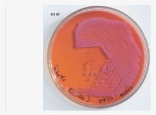 Pseudomallei Cultured In Macconkey Agar - Coin #9908589